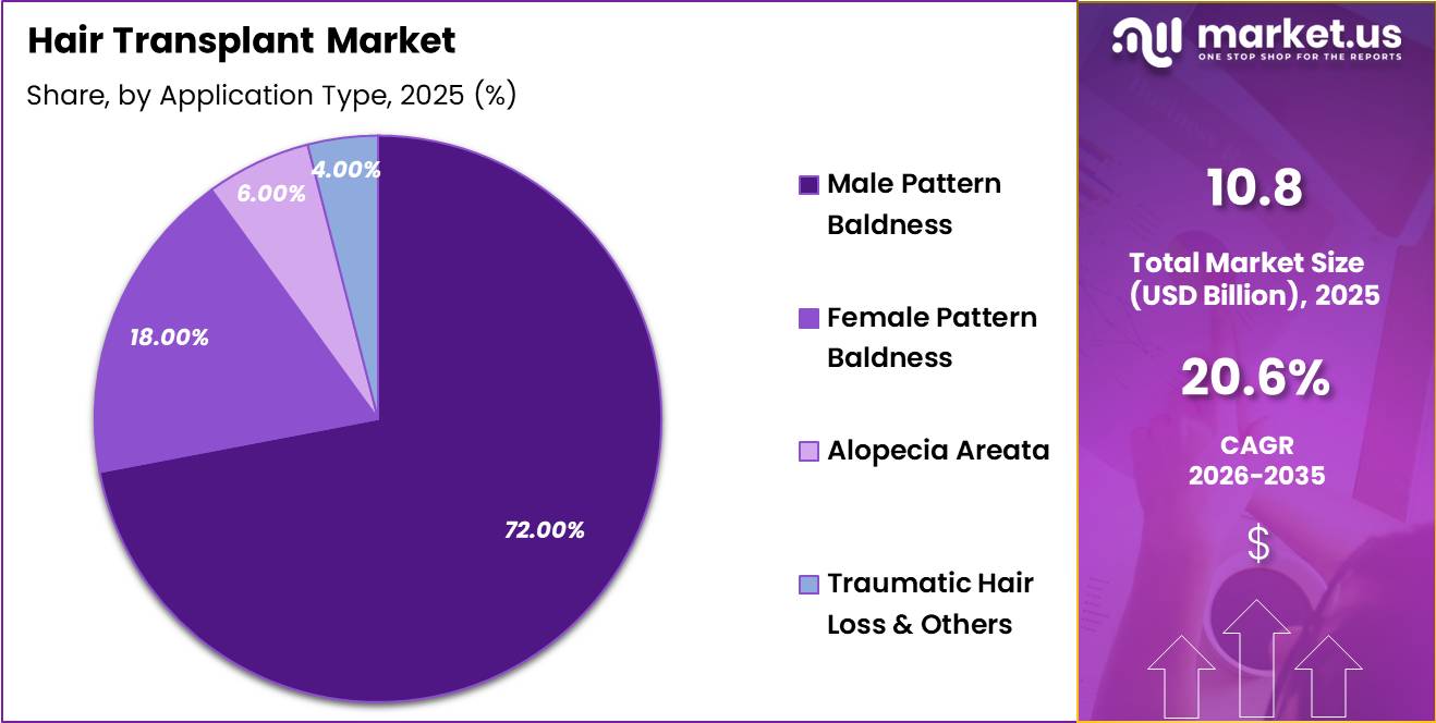 Hair Transplant Market Share