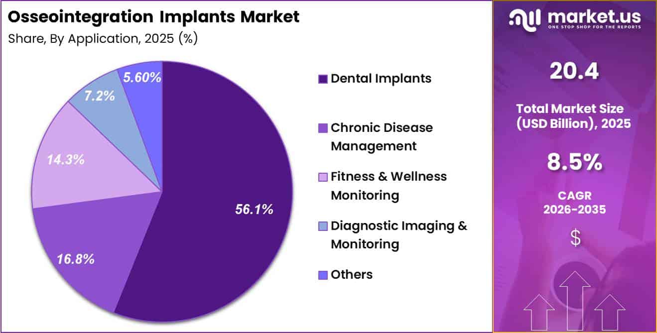 Osseointegration Implants Market Share
